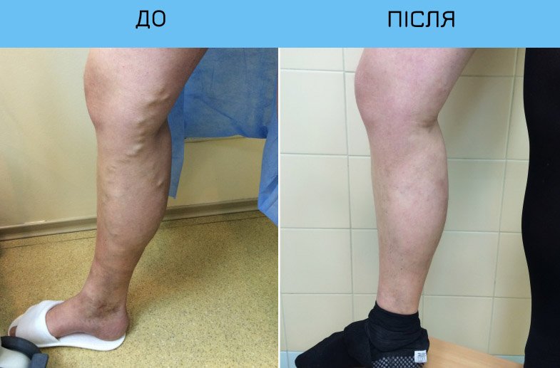 Реальна історія з життя